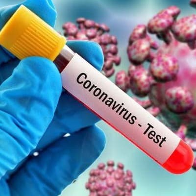 Por decisión del Gobierno de Armenia, se establecerá la cuarentena en el país a partir del 11 de septiembre, desde las 17:00 horas hasta el 11 de enero, inclusive. La decisión de 4 meses fue publicada en el sitio web e-gov.am.